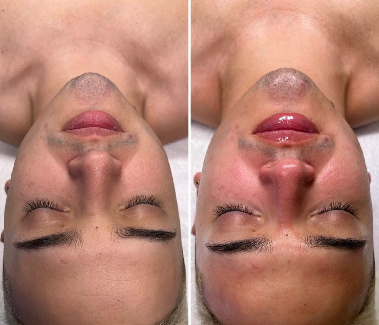 Premium care and attention