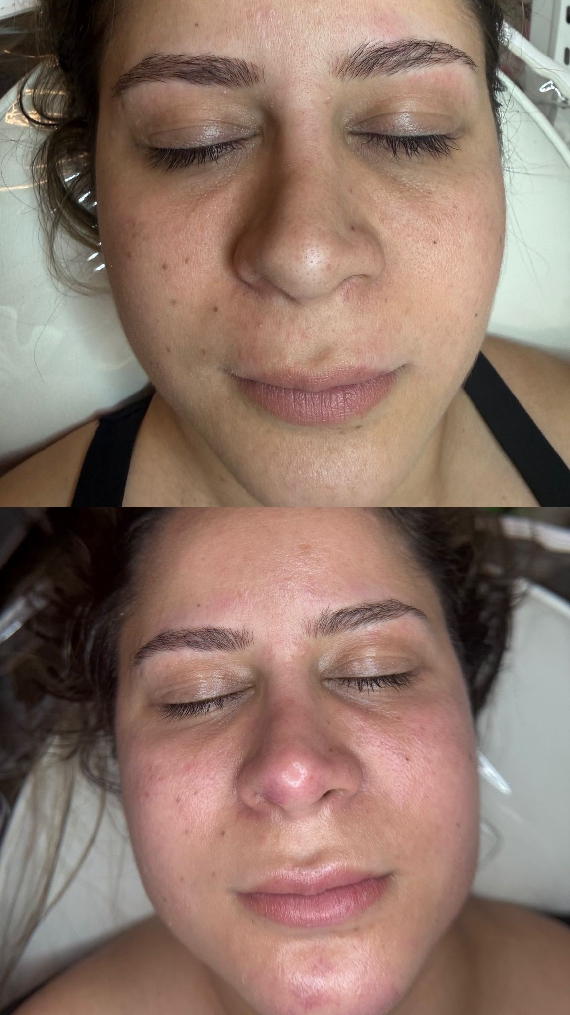 Deep Cleansing Treatment
