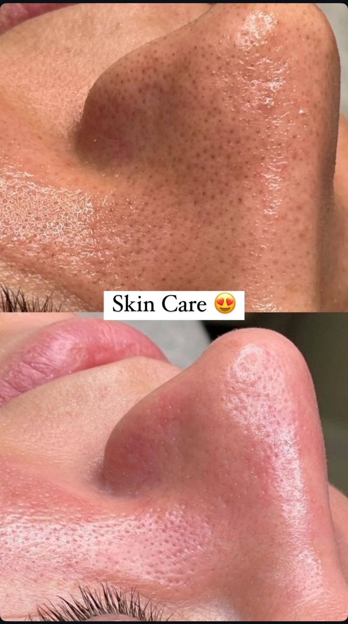Collagen Boost Treatment