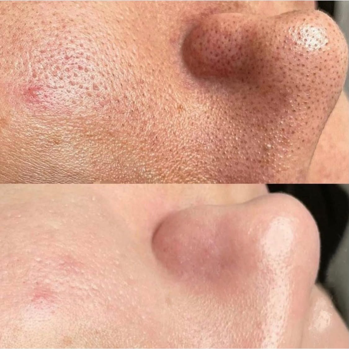 Anti-Aging Radiance Therapy