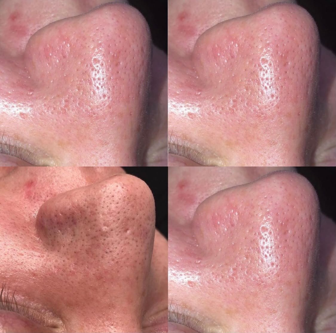 Vitamin C Brightening Facial